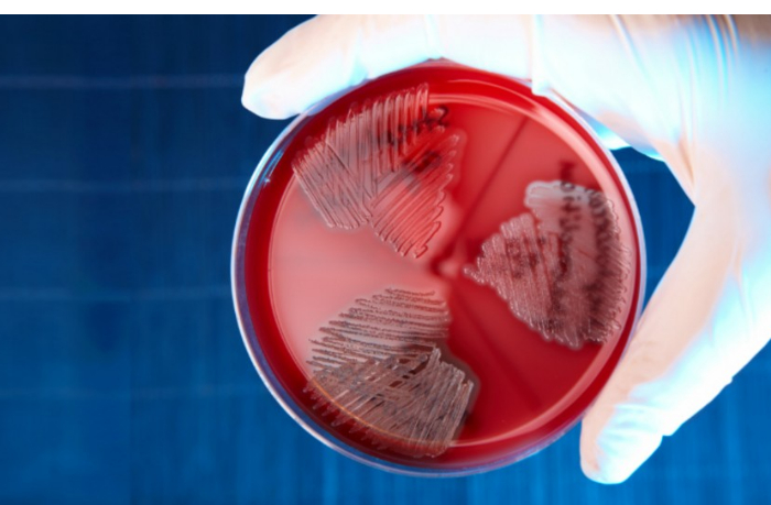 v-gonkonge-streptokokkovoy-infektsiey-zarazilis-minimum-27-chelovek