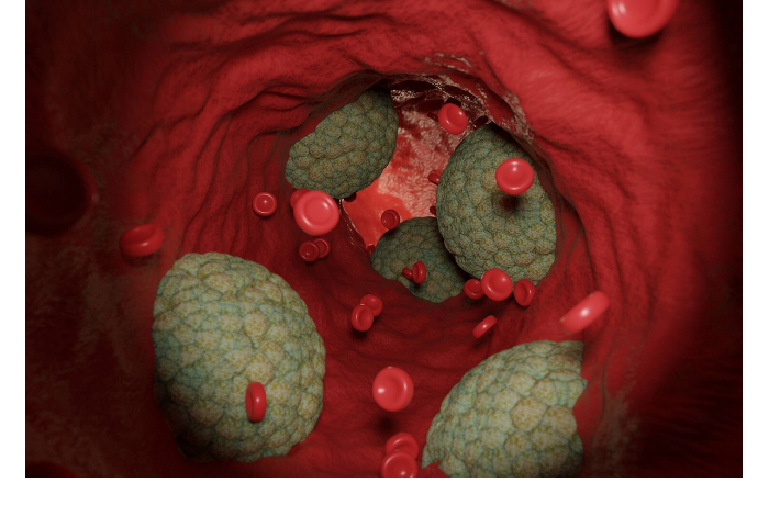 nazvan-neochevidnyy-faktor-riska-prezhdevremennoy-smerti