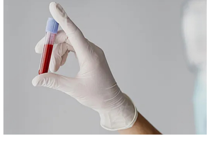 vsego-odin-analiz-pokazhet-vsyo-li-v-poryadke-s-shchitovidkoy-v-50