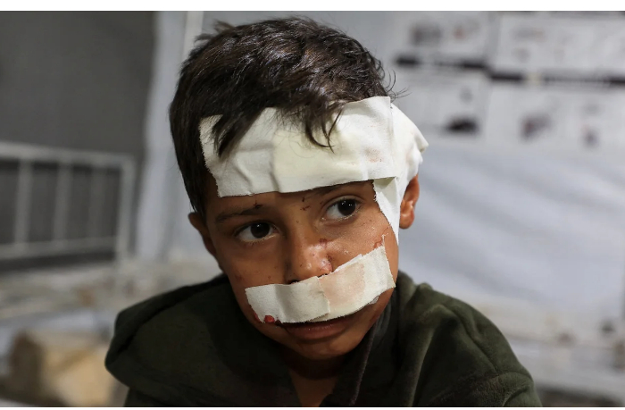 ranenye-v-gaze-umirayut-v-ozhidanii-pomoshchi