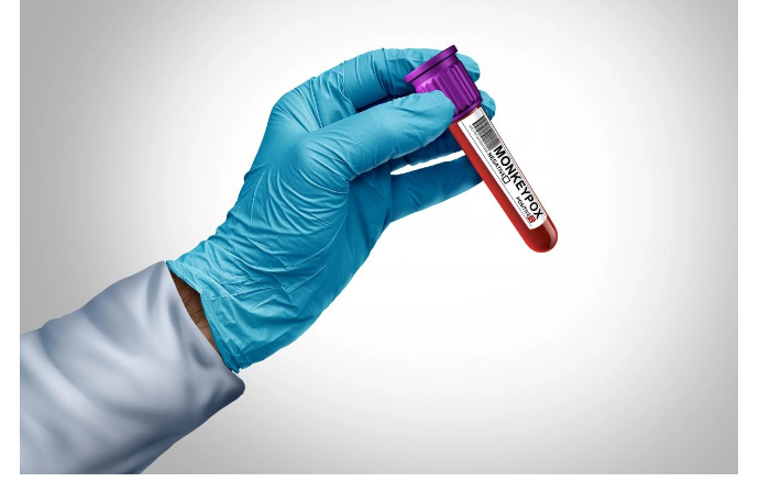 vrachi-byut-trevogu-na-yevropu-nastupaet-mutirovavshiy-shtamm-obezyaney-ospy