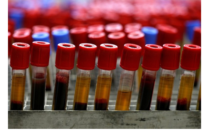 nayden-sposob-tochno-predskazat-risk-ranney-smerti