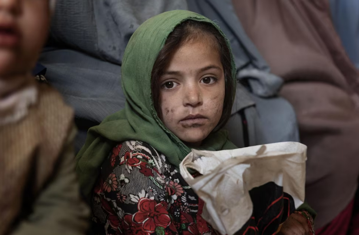 oon-preduprezhdaet-bolee-17-millionov-afgantsev-stolknutsya-s-prodovolstvennym-krizisom