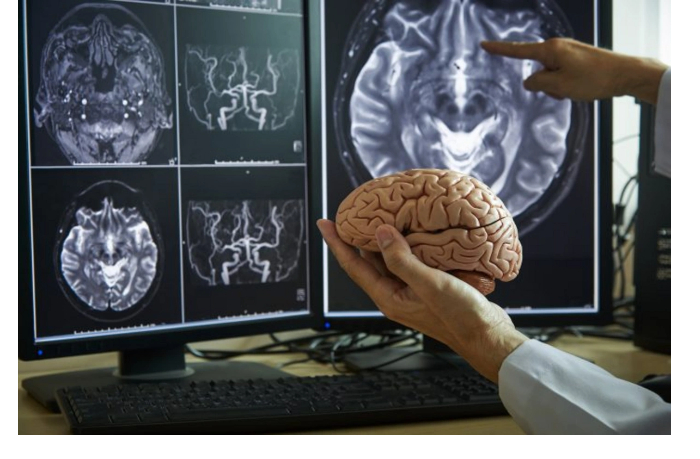 nayden-sposob-bystro-vosstanovit-mozg-posle-insulta