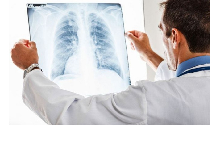 v-proshlom-godu-v-azerbaydzhane-bolee-200-chelovek-skonchalis-ot-tuberkuleza