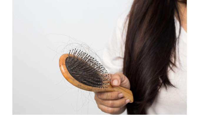 nazvany-neochevidnye-prichiny-vypadeniya-volos