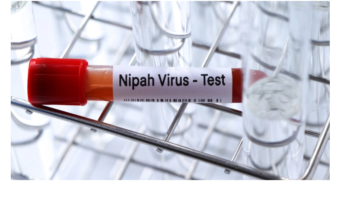 vrachi-obyasnili-kak-raspoznat-smertelno-opasnyy-virus-nipakh-vovremya