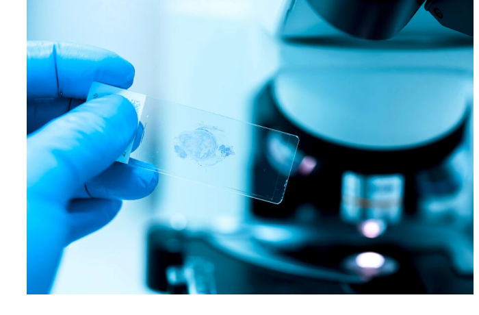 nazvan-tip-pitaniya-kotoryy-snizhaet-riski-razvitiya-raka