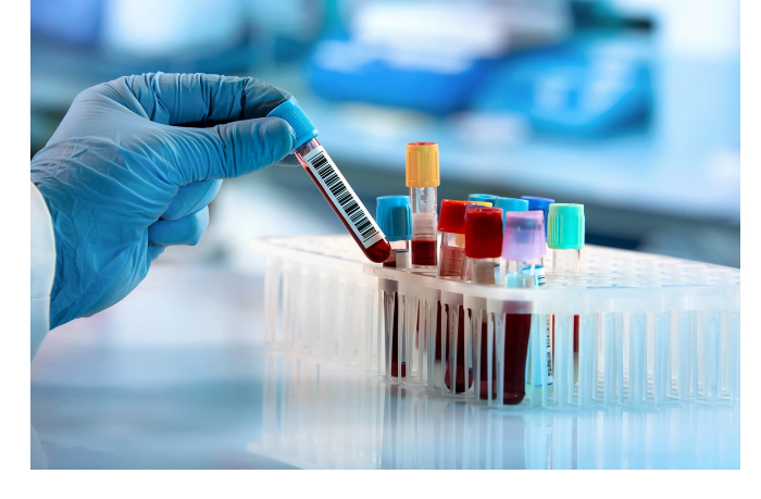 prichinu-vysokogo-davleniya-nashli-v-mozge