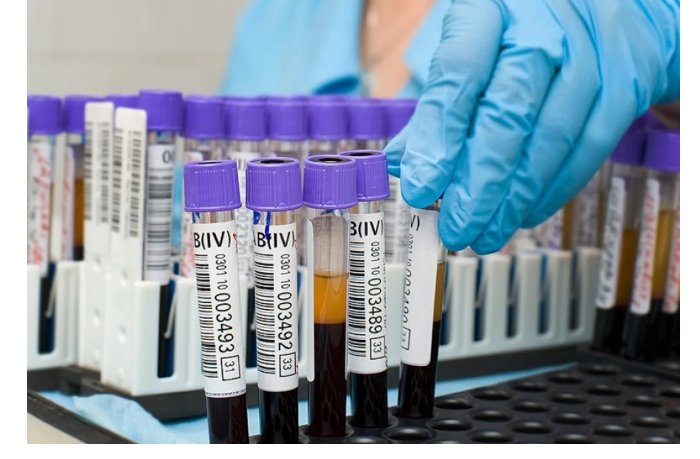 v-azerbaydzhane-na-dispansernom-uchete-sostoyat-1779-bolnykh-gemofiliey