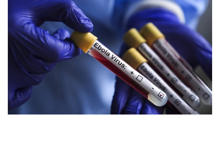 v-minzdrave-otsenili-veroyatnost-vspyshki-likhoradki-ebola-v-azerbaydzhane
