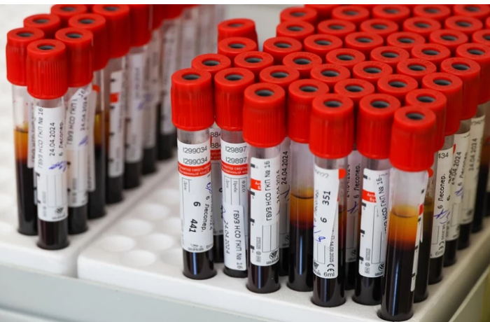 sozdan-test-krovi-pozvolyayushchiy-bystro-vyyavlyat-zarazhenit-tuberkulezom