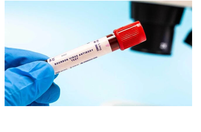 virus-burbon-grozit-li-azerbaydzhanu-novaya-infektsiya