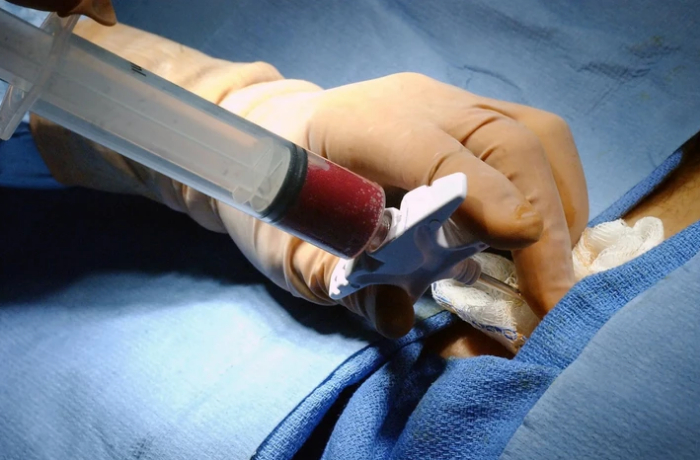 baku-medical-plaza-razreshili-provodit-transplantatsiyu-stvolovykh-kletok